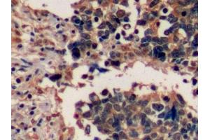 Immunohistochemistry (IHC) image for anti-Epidermal Growth Factor Receptor (EGFR) (AA 888-1210) antibody (ABIN7443362)