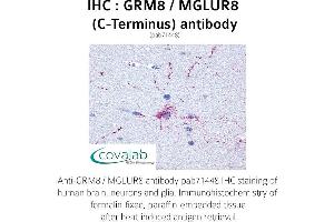 Image no. 1 for anti-Glutamate Receptor, Metabotropic 8 (GRM8) (C-Term) antibody (ABIN1735283) (GRM8 antibody  (C-Term))