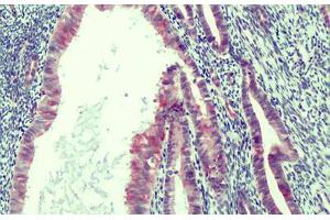 Human Endometrium: Formalin-Fixed, Paraffin-Embedded (FFPE) (RCAN2 antibody  (Internal Region))