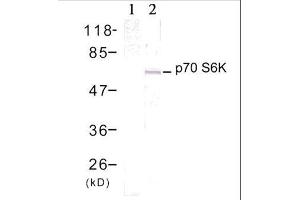 Western blot analysis of extract from 293 cells treated with EGF (200ng/ml, 15min), using p70 S6 Kinase (Ab-389) antibody (E021182, Lane 1 and 2). (RPS6KB1 antibody)