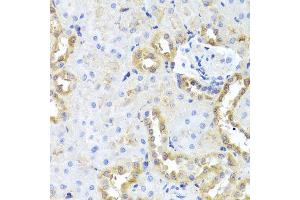 Immunohistochemistry of paraffin-embedded rat kidney using CGB7 antibody (ABIN5974696) at dilution of 1/100 (40x lens). (CGB7 antibody)