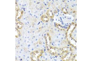 Immunohistochemistry of paraffin-embedded rat kidney using CGB7 antibody (ABIN5974696) at dilution of 1/100 (40x lens).