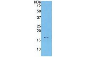 WB of Protein Standard: different control antibodies  against Highly purified E. (S100A6 ELISA Kit)