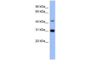 PRKY antibody used at 1 ug/ml to detect target protein. (PRKY antibody  (N-Term))