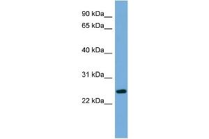 WB Suggested Anti-C6orf94 Antibody Titration:  0. (FAM164B antibody  (N-Term))