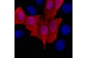 Immunofluorescent analysis of His-tag staining in 293T cells transfected with a His-tag protein. (His Tag antibody)
