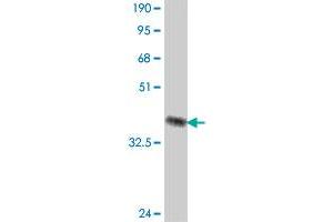 Western Blot detection against Immunogen (37 KDa) . (Cullin 4A antibody  (AA 1-100))