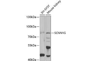 Western blot analysis of extracts of various cell lines, using SCNN1G antibody (ABIN6129468, ABIN6147453, ABIN6147454 and ABIN6221724) at 1:1000 dilution. (SCNN1G antibody  (AA 85-355))