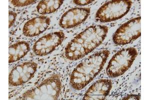 Image no. 1 for anti-Erythrocyte Membrane Protein Band 4.1 (Elliptocytosis 1, RH-Linked) (EPB41) (AA 116-226) antibody (ABIN598666) (EPB41 antibody  (AA 116-226))