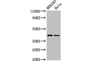 Western Blot Positive WB detected in: HEK293 whole cell lysate, Hela whole cell lysate All lanes: GALK1 antibody at 3 μg/mL Secondary Goat polyclonal to rabbit IgG at 1/50000 dilution Predicted band size: 43, 46 kDa Observed band size: 43 kDa (GALK1 antibody  (AA 23-164))