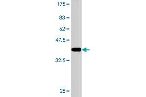 Western Blot detection against Immunogen (36. (DCP1A antibody  (AA 186-285))