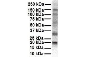WB Suggested Anti-KCNAB2 antibody Titration: 1 ug/mL Sample Type: Human HepG2 (KCNAB2 antibody  (Middle Region))
