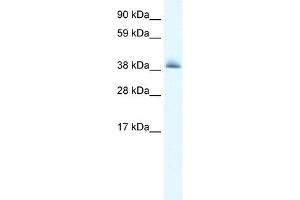 KCTD13 antibody used at 0. (KCTD13 antibody  (N-Term))