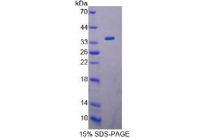 SDS-PAGE analysis of Human EIF4A1 Protein. (EIF4A1 Protein)