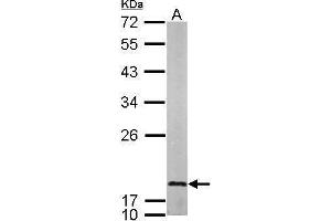 WB Image Sample (50 ug of whole cell lysate) A: mouse brain 12% SDS PAGE antibody diluted at 1:1000 (LMO1 antibody)