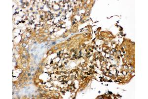Anti-CIAS1/NALP3 antibody, IHC(P) IHC(P): Human Tonsil Tissue (NLRP3 antibody  (N-Term))