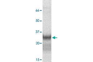 The tissue lysate derived from mouse kidney was immunoprobed by CISH polyclonal antibody  at 1 : 500. (CISH antibody)