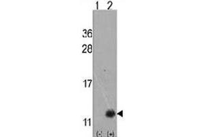 Western blot analysis of URM1 polyclonal antibody . (Urm1 antibody  (N-Term))