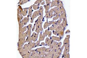 IHC analysis of ATP5F1B using anti-ATP5F1B antibody (ABIN7599866). (Atp5f1b (AA 123-529) antibody)