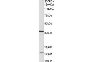 Western Blotting (WB) image for anti-Kelch Domain Containing 8B (KLHDC8B) (Internal Region) antibody (ABIN2464990) (KLHDC8B antibody  (Internal Region))