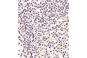 Paraformaldehyde-fixed, paraffin embedded human tonsil, Antigen retrieval by boiling in sodium citrate buffer (pH6. (RPA2 antibody)