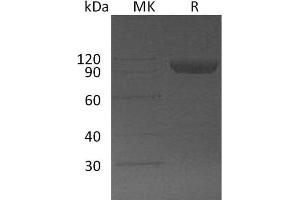 Western Blotting (WB) image for Alpha2 Antiplasmin (SERPINF2) protein (Fc Tag) (ABIN7320644) (alpha 2 Antiplasmin Protein (Fc Tag))