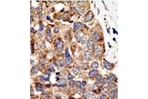 Image no. 2 for anti-Protein Inhibitor of Activated STAT, 4 (PIAS4) (C-Term) antibody (ABIN356771) (PIAS4 antibody  (C-Term))