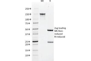 SDS-PAGE Analysis Purified Cytokeratin 18 Mouse Monoclonal Antibody (DC10). (Cytokeratin 18 antibody)