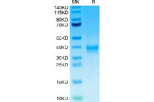 ANTXR2 Protein (AA 34-318) (His tag)