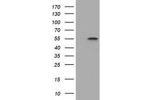 HEK293T cells were transfected with the pCMV6-ENTRY control (Left lane) or pCMV6-ENTRY DYNC1LI1 (Right lane) cDNA for 48 hrs and lysed. (DYNC1LI1 antibody)