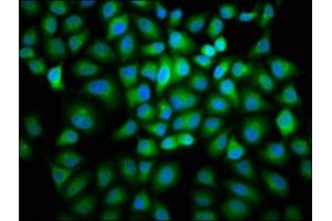 Immunofluorescence staining of Hela cells with ABIN7153405 at 1:166, counter-stained with DAPI. (Cyclin B2 antibody  (AA 7-163))