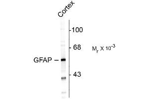 Western blots of rat cortex lysate showing specific immunolabeling of the ~ 50k GFAP protein. (GFAP antibody)