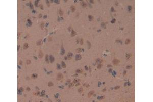 IHC-P analysis of brain tissue, with DAB staining. (Oligophrenin 1 antibody  (AA 634-802))