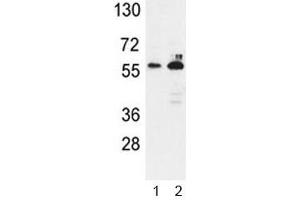 Western blot analysis of G6PD antibody and 1) K562, 2) MCF-7 lysate. (Glucose-6-Phosphate Dehydrogenase antibody  (AA 297-326))