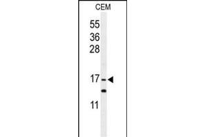 Western blot analysis of GMFG Antibody (C-term) (ABIN652407 and ABIN2841991) in CEM cell line lysates (35 μg/lane). (GMFG antibody  (C-Term))