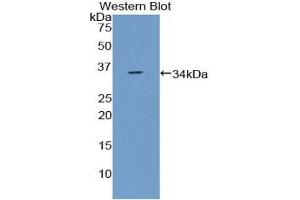 Western blot analysis of the recombinant protein. (CCDC80 antibody  (AA 635-906))