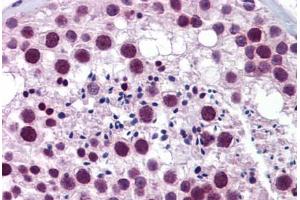 Human Testis: Formalin-Fixed, Paraffin-Embedded (FFPE) (TRIM22 antibody  (AA 74-123))