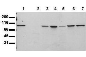 Western Blotting (WB) image for anti-Signal Transducer and Activator of Transcription 6, Interleukin-4 Induced (STAT6) antibody (ABIN126902) (STAT6 antibody)