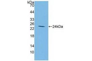 Detection of Recombinant IGFBP2, Human using Polyclonal Antibody to Insulin Like Growth Factor Binding Protein 2 (IGFBP2) (IGFBP2 antibody  (AA 148-325))