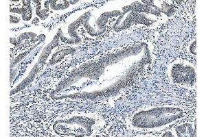 anti-Protein Phosphatase, Mg2+/Mn2+ Dependent, 1A (PPM1A) (N-Term) antibody