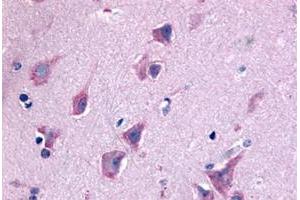 Immunohistochemical staining of human brain, neurons and glia with QRFPR polyclonal antibody . (QRFPR antibody  (N-Term))