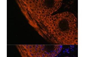 Immunofluorescence analysis of Mouse skin cells using TGM1 Polyclonal Antibody at dilution of 1:100. (TGM1 antibody)