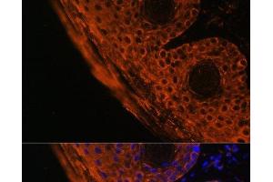 Immunofluorescence analysis of Mouse skin cells using TGM1 Polyclonal Antibody at dilution of 1:100.