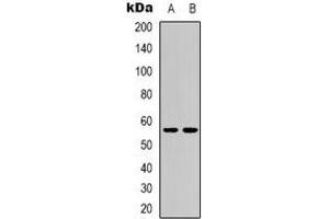 Western blot analysis of CD276 expression in MCF7 (A), HEK293T (B) whole cell lysates. (CD276 antibody)