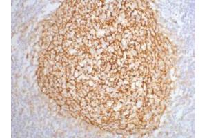 Immunohistochemistry (IHC) image for anti-Complement Component (3d/Epstein Barr Virus) Receptor 2 (CR2) antibody (ABIN3181130) (CD21 antibody)