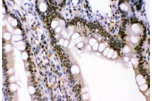 IHC analysis of p95 NBS1 using anti-p95 NBS1 antibody (ABIN3043282).