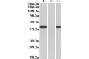 HEK293 lysate (10ug protein in RIPA buffer) overexpressing Human FANCF with C-terminal MYC tag probed with AP22406PU-N (0. (FANCF antibody  (C-Term))