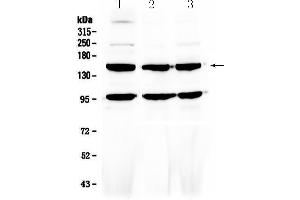 Western blot analysis of VEGF Receptor 3 using anti-VEGF Receptor 3 antibody . (FLT4 antibody)