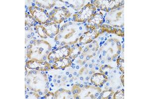 Immunohistochemistry of paraffin-embedded mouse kidney using PEX5 antibody (ABIN6133015, ABIN6145469, ABIN6145471 and ABIN6221464) at dilution of 1:100 (40x lens).