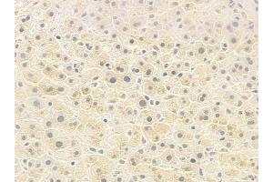 ABIN6259284 and ABIN6273374 at 1/100 staining human normal liver tissue by IHC-P.